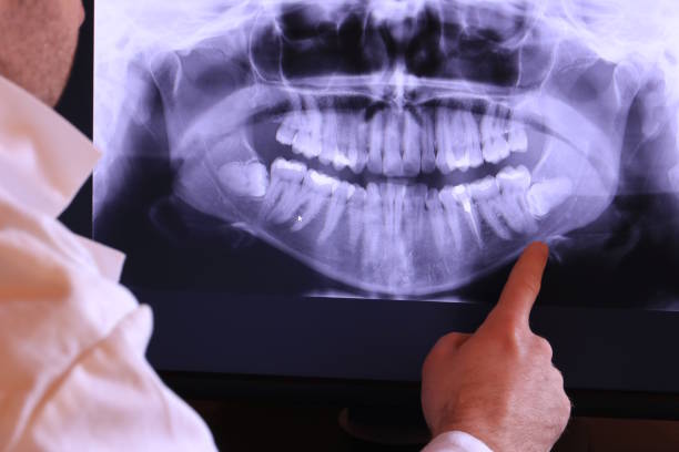 Best Holiday Emergency Dentist in Moody, TX