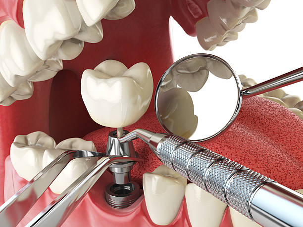 Best Emergency Cosmetic Dentistry in Moody, TX